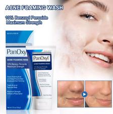 Acne Foaming Wash Face & Body 10% Active ingredient 156g New UK Moisture